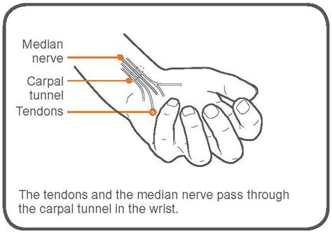 Carpal Tunnel Syndrome Stretches