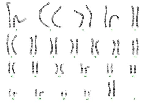 Chromosomenanalysen – allgemeine Informationen – DNA-Diagnostik Hamburg : Gemeinschaftspraxis ...