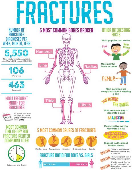 5 Most Common Bone Fractures for Kids | Sports and Spine Orthopaedics