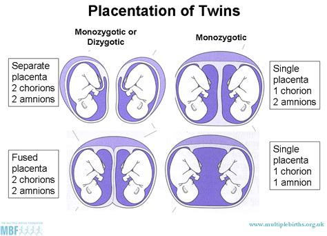 Pin on Naturally Parenting Twins