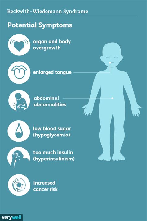 Beckwith-Wiedemann Syndrome: Symptoms, Cause, Diagnosis