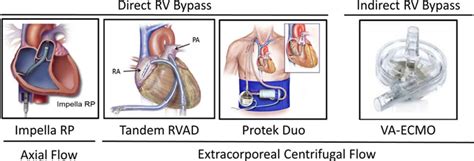 Mechanical Circulatory Support Devices for Acute Right Ventricular ...