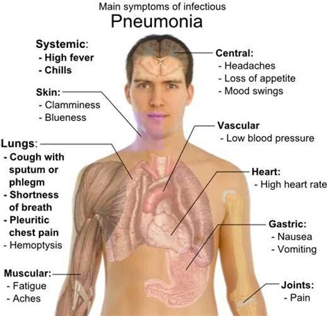 Pneumonia symptoms | Pneumonia symptoms, Pneumonia treatment, Asthma treatment