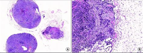 (A) Panoramic image of the intramammary lymph node dissected, all... | Download Scientific Diagram