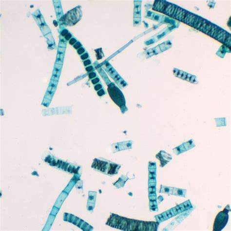 Mixed Green Algae, w.m. Microscope Slide | Carolina Biological Supply