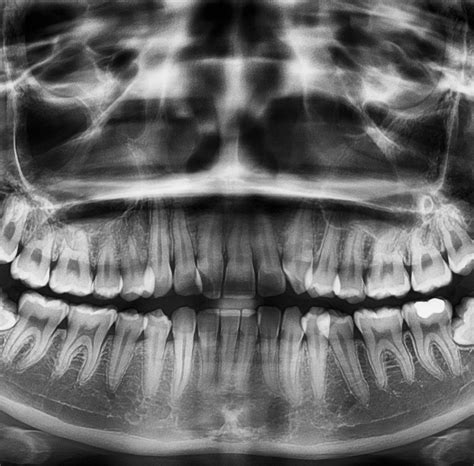 Dental - Professional Radiology Outcomes