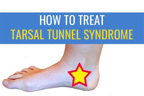 Medial Ankle Pain: Tarsal Tunnel Syndrome | Sports Injury Physio