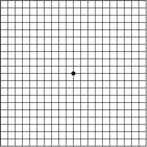 Macular Degeneration - Amsler Grid – Brisbane Retina | Dr Abhishek Sharma