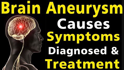 Brain Aneurysm - Causes, Symptoms, Warning Signs, Treatment