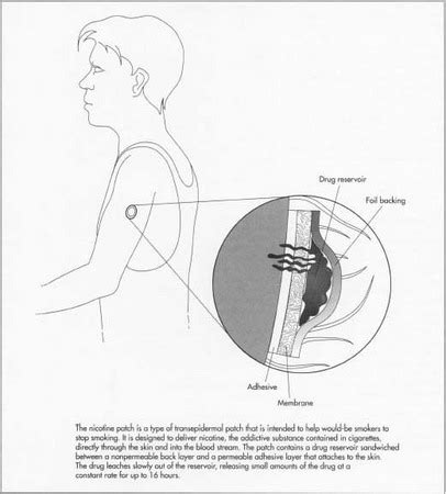 How nicotine patch is made - material, used, processing, components ...