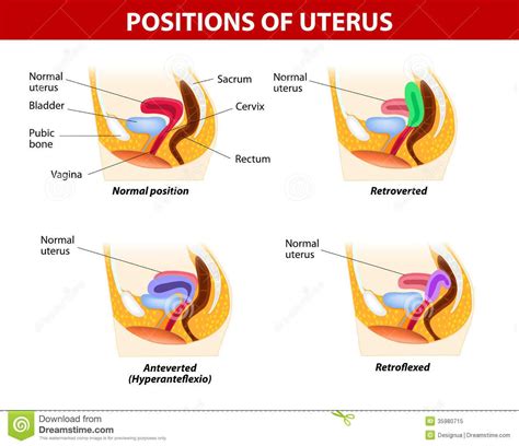 http://thumbs.dreamstime.com/z/positions-uterus-diagram-variants-uterine-position-normal-rests ...