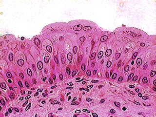 Histology Slides: Transitional Epithelium