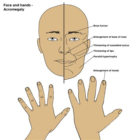 [Figure, Illustration of physical attributes of...] - StatPearls - NCBI ...