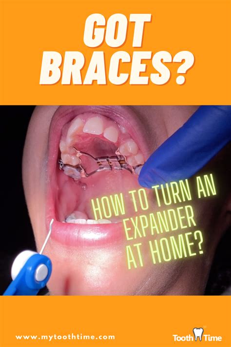 Got Braces? in 2021 | Family dentistry, Dentistry, Teeth