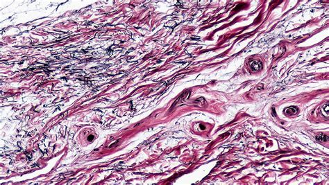 Connective Tissue: Human Elastic Tissue | cross section: hum… | Flickr