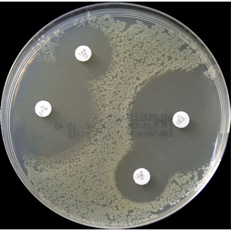 Muller Hinton Agar / Mueller Hinton Agar Mha Composition Preparation Uses Microbe Online : Aug ...