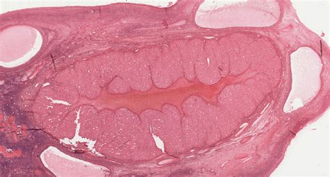 Female Reproductive System | histology