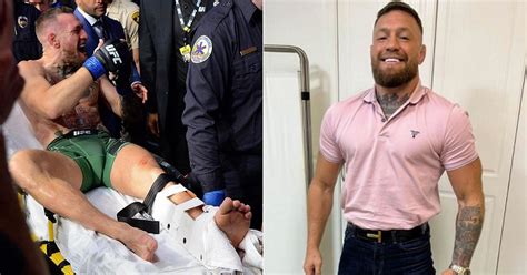 Conor McGregor injury update after he sees doctor over broken leg ...