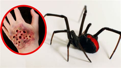 THE MOST POISONOUS SPIDERS In The World - YouTube