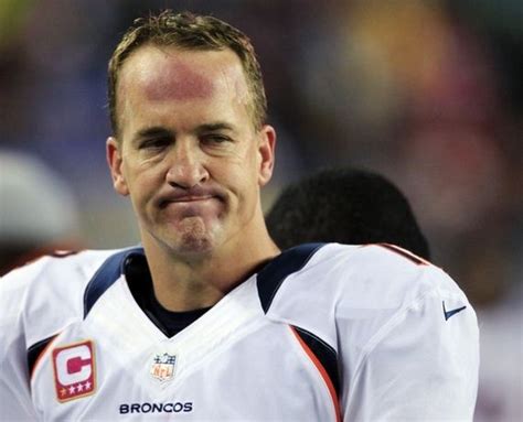 What Is Wrong With Peyton Manning's Forehead? - Barnorama