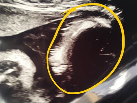 I had an ultrasound today at 30 weeks and look at this hair!! : r/BabyBumps