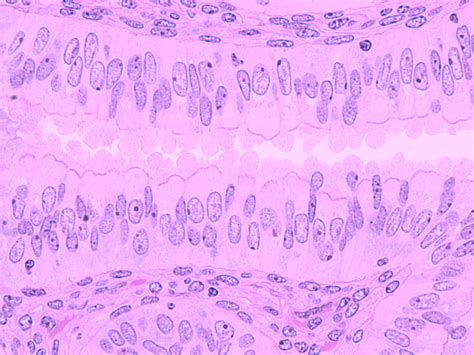 Oviduct Epithelium