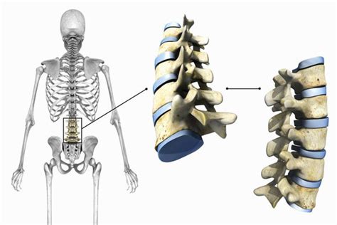 The 3 Types of Joints in the Body