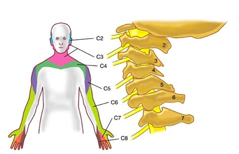 Cervical Nerves - Pain Neck