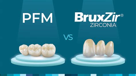 Zirconia Versus PFMs: Which Should You Crown the Winner?