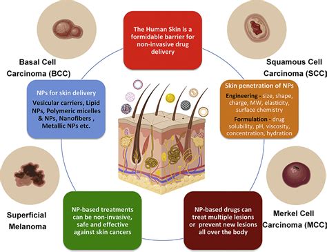 Nanoparticles for topical drug delivery: Potential for skin cancer treatment - Pharma Excipients