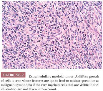 Miscellaneous Primary Tumors, Secondary Tumors, and Nonneoplastic Lesions of the Ovary ...