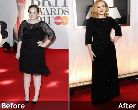 Adele’s Before and After Surgery Photos Show Proof of the Singer’s Transformation – Back Beat Funds