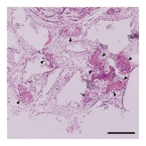 Histological analysis (H-E staining, x200). Scale bar = 200μm. (a, b ...