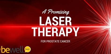 A Promising Laser Therapy for Prostate Cancer | BeWellBuzz