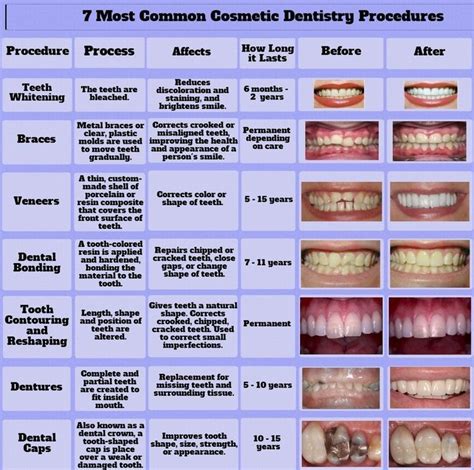 Most Common Cosmetic Dentistry Procedures | Cosmetic dentistry, Cosmetic dentistry procedures ...