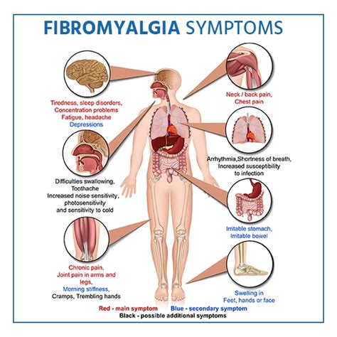 Fibromyalgia | Smart Pain Solutions | Bridgeton & Clayton Missouri