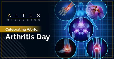 Celebrating World Arthritis Day - Altus Biologics