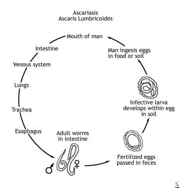 Ascaris Lumbricoides: Background, Pathophysiology, Epidemiology