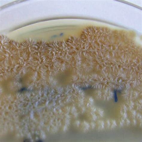 Origin of samples of Sporothrix schenckii | Download Table