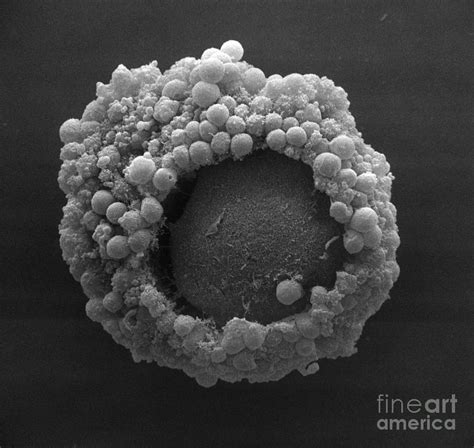 Cumulus Oophorus Cells Photograph by David M. Phillips