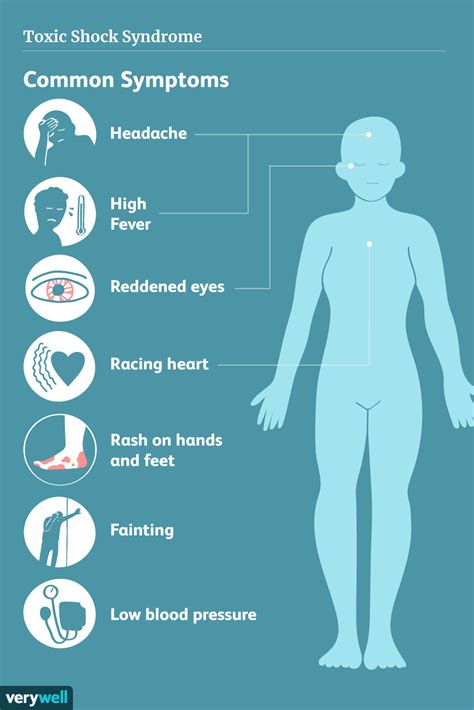 What is toxic shock syndrome?