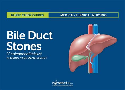 Bile Duct Stones (Choledocholithiasis) Nursing Care and Management Study Guides | Bile duct ...