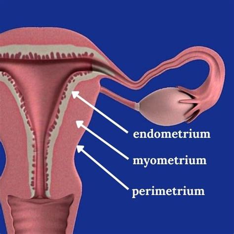 Adenomyosis by MRI reduces live births in endometriosis patients | Remembryo