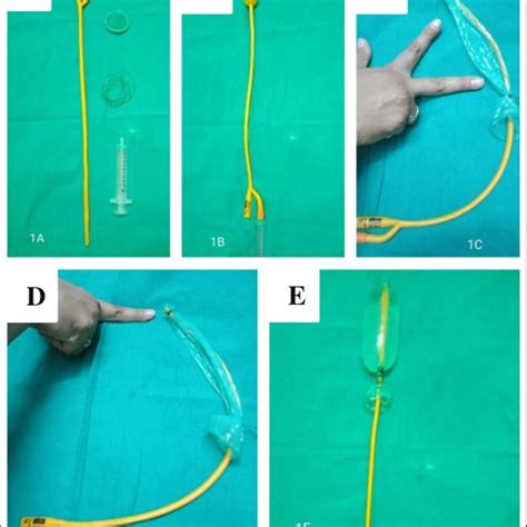 Steps of formation of condom catheter. (A): Equipment's used to prepare... | Download Scientific ...