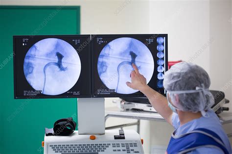 Ureteroscopy and Laser Lithotripsy - Stock Image - C034/3526 - Science Photo Library