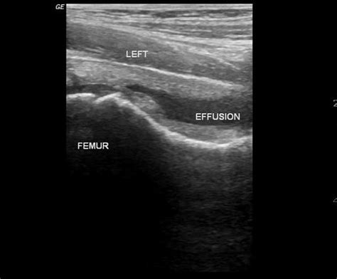 AMSER MSK definitions | Imaging