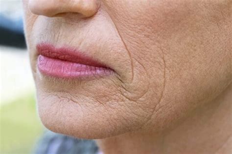 The 5 Types of Skin Aging and How to Identify Them