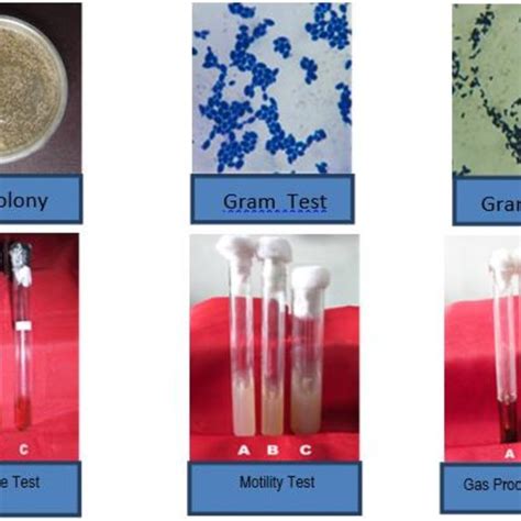 A series of lactic acid bacteria identification tests. | Download Scientific Diagram