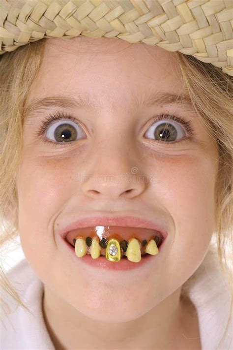 Rotten teeth child upclose stock photo. Image of occasion - 3842104