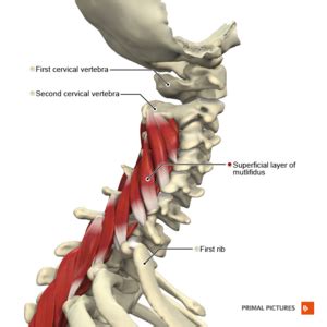 Text Neck - Physiopedia